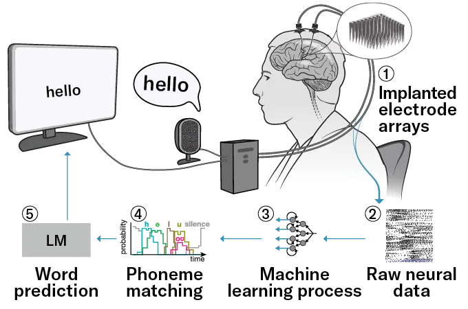 A graphic explaining how Casey Harrell’s brain-computer functions (described by caption)