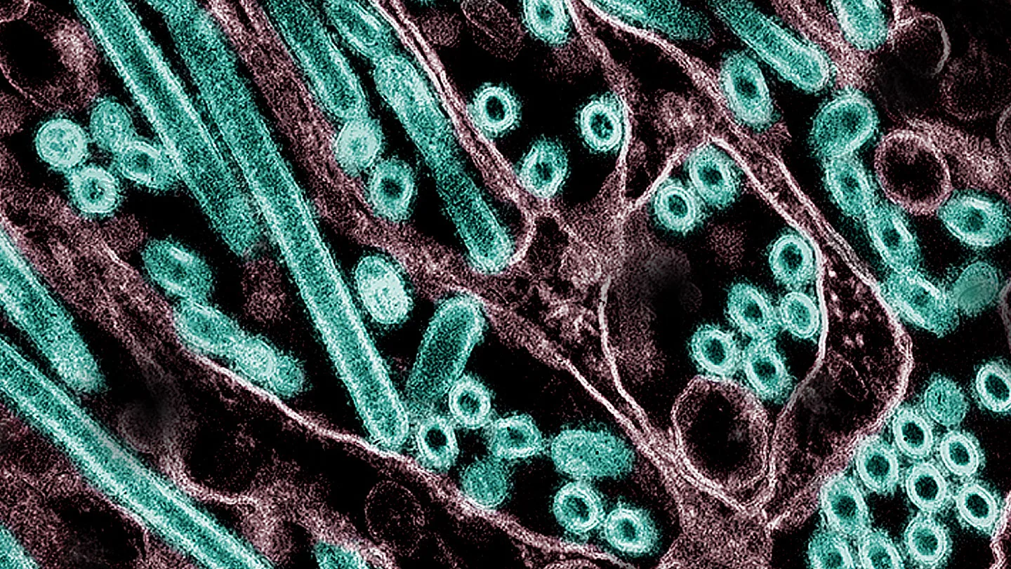 A microscope image of bird flu particles and kidney cells.