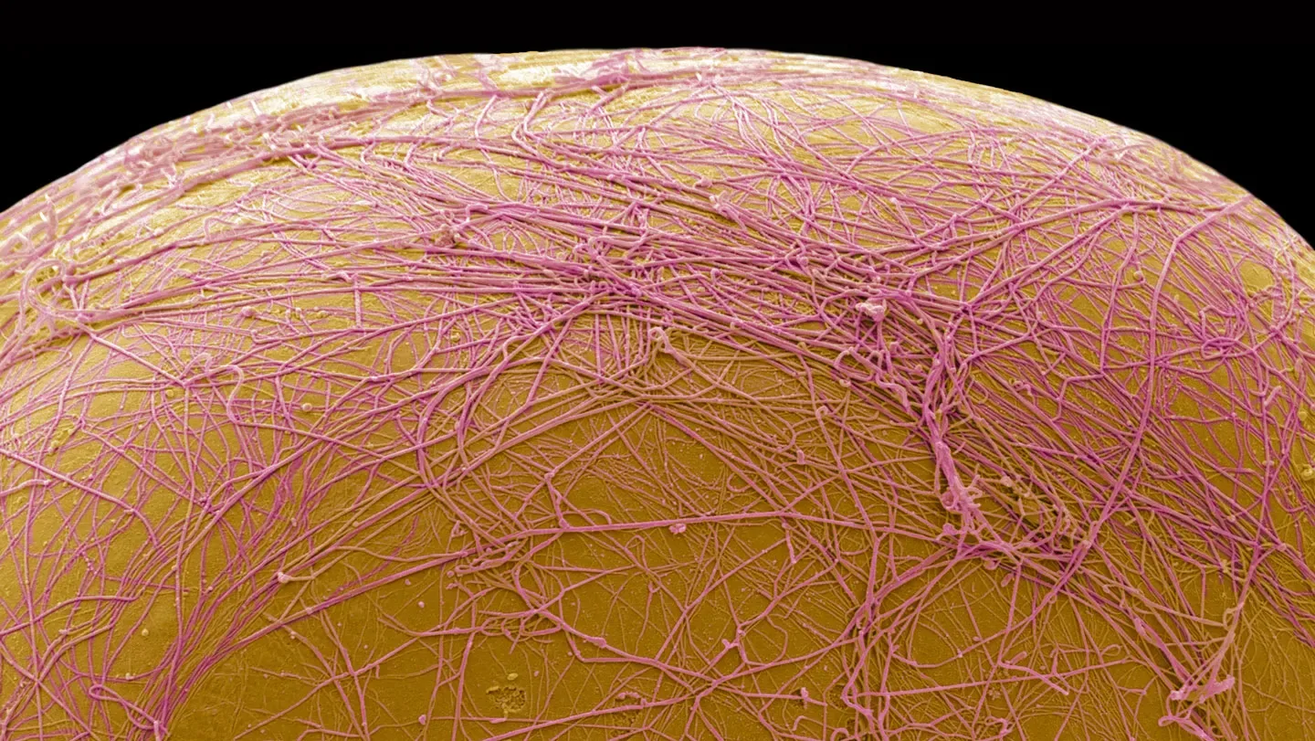 The curve of a yellow fat cell rises like a moon against a black background. Strands of pink threads cover the cells.