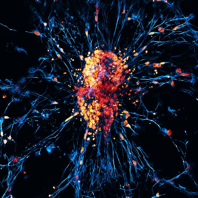 Bright clusters of cell nuclei dot a branching web of human neurons grown from reprogrammed stem cells.