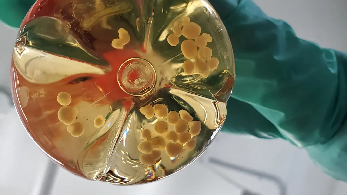 A hand holds a gel-like disc filled with dozens of small white lumps to the camera